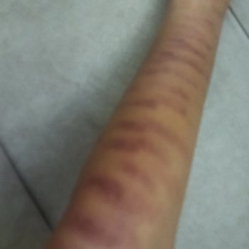 Zülal Göçmen Beauty Lounge Oluşan İzlerle İlgilenmedi