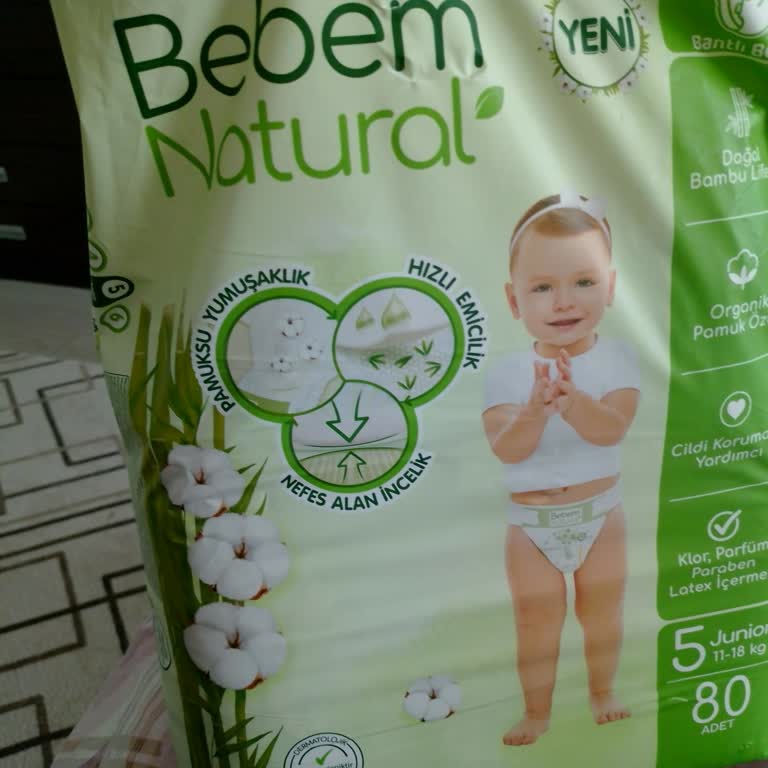 Sızdıran Ve Koku Yayan Bebek Bezi Bebeğime Zarar Verdi