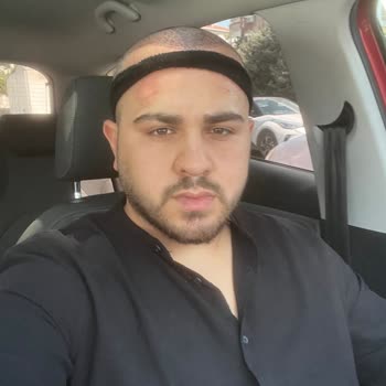 Saç Ekimi Sonrası Yüzde Kalıcı İz Ve Yetersiz Çözüm Önerisi