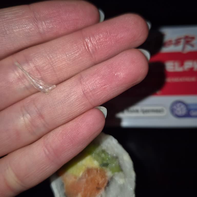 Siparişimde Bozuk Ürün Ve Yabancı Cisim Sorunu, İade Gerçekleşmedi