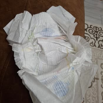 Molfix 6 Numara Bebek Bezinde Sürekli İncelik Ve Boşluk Sorunu, İade Talebim Karşılanmadı