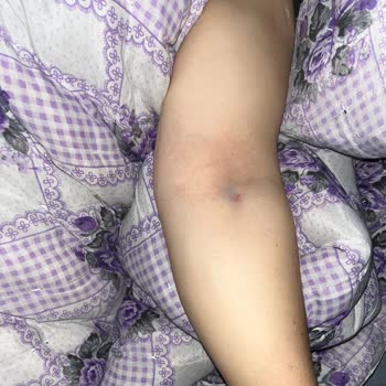 Tomografi Sırasında İlgisizlik Ve Sağlık Çalışanlarının Uygunsuz Davranışları