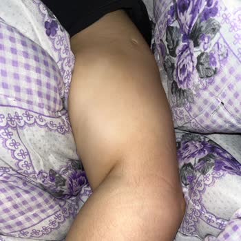 Tomografi Sırasında İlgisizlik Ve Sağlık Çalışanlarının Uygunsuz Davranışları