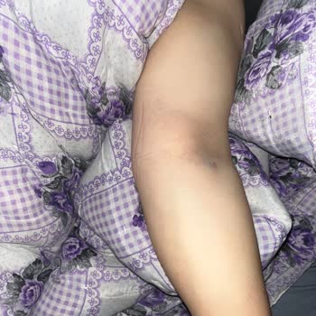 Tomografi Sırasında İlgisizlik Ve Sağlık Çalışanlarının Uygunsuz Davranışları