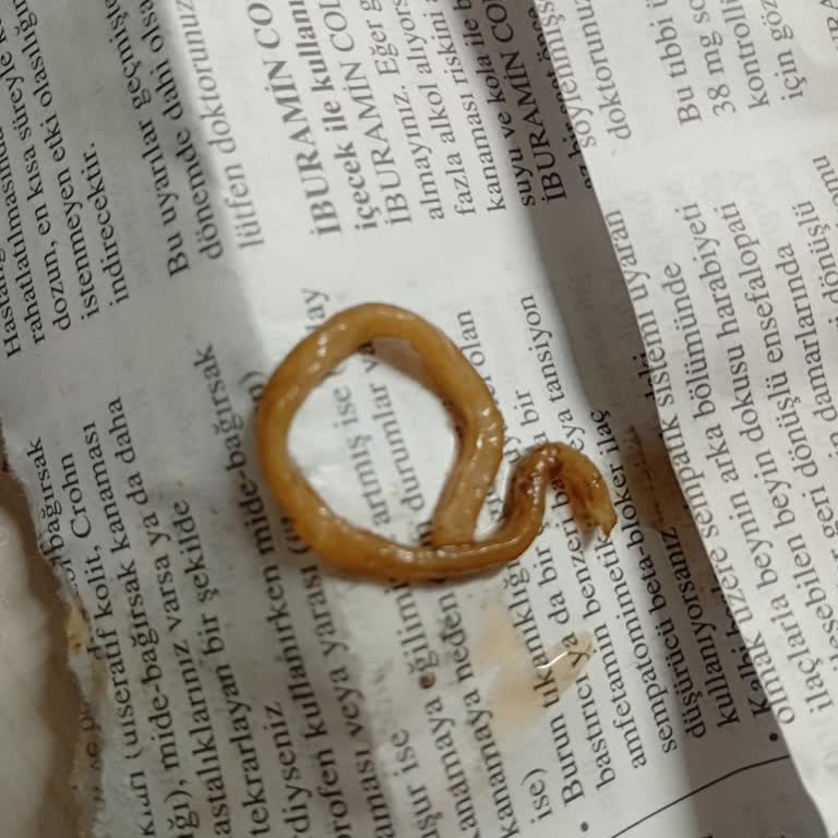 Pepsi Koladan Çıkan Solucan