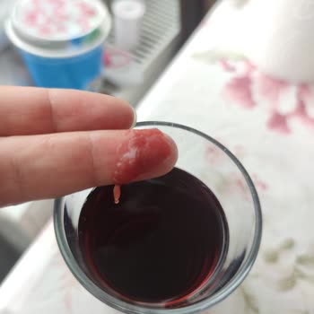 Vişne Suyunda Yabancı Maddeyle Karşılaştım Şaşkınım