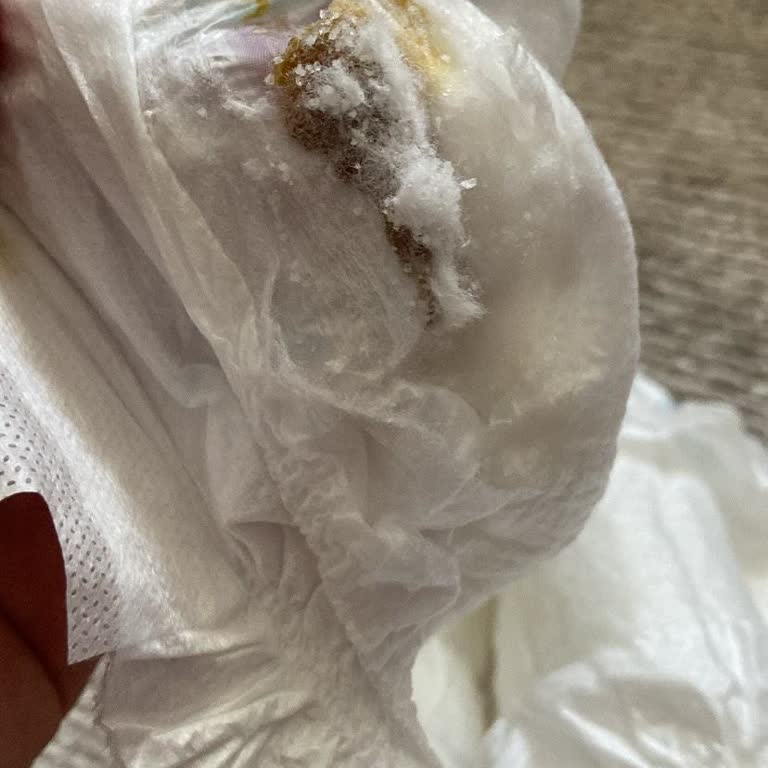 Molfix Bebek Bezinde Siyah Yapışkan Maddeyle Karşılaştım