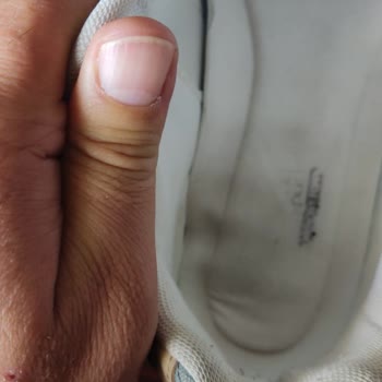 Aynı Model Ayakkabıda Tekrarlayan Sorun Ve Farklı İnceleme Sonucu