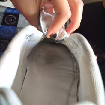 Aynı Model Ayakkabıda Tekrarlayan Sorun Ve Farklı İnceleme Sonucu