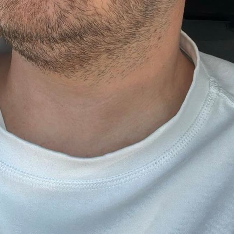 Bir Kez Giyilen T-shirtte Ciddi Yamulma Ve Çözüm Sunulmaması