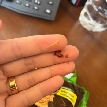 Eti Form Bitter Çikolata Kaplı Bisküvi İçinden Yabancı Madde Çıkması