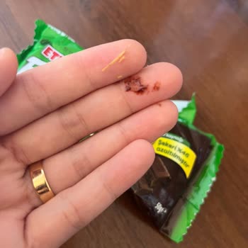 Eti Form Bitter Çikolata Kaplı Bisküvi İçinden Yabancı Madde Çıkması