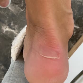 Yüksek Fiyatlı Ayakkabıda Kısa Sürede Ciddi Hasar Ve Mağduriyet