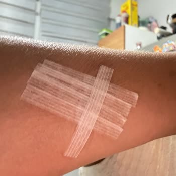 Cerrahi İşlem Yapılmadan Fazla Ücret Alınması Ve Yanlış Faturalandırma