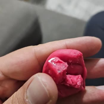 Oyun Hamurunda Cam Ve Yabancı Cisim Şoku
