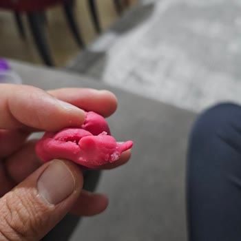 Oyun Hamurunda Cam Ve Yabancı Cisim Şoku