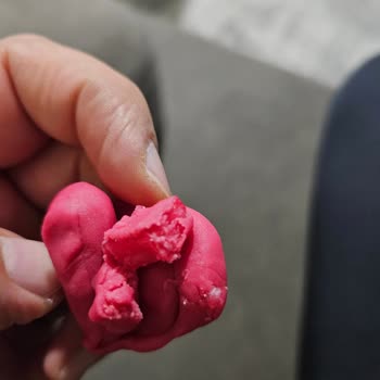 Oyun Hamurunda Cam Ve Yabancı Cisim Şoku