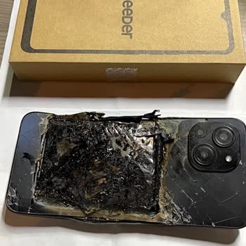 Reeder Şarjda Patlayan Telefon Babamı Yaraladı, Mağaza Sorumluluk Almıyor!