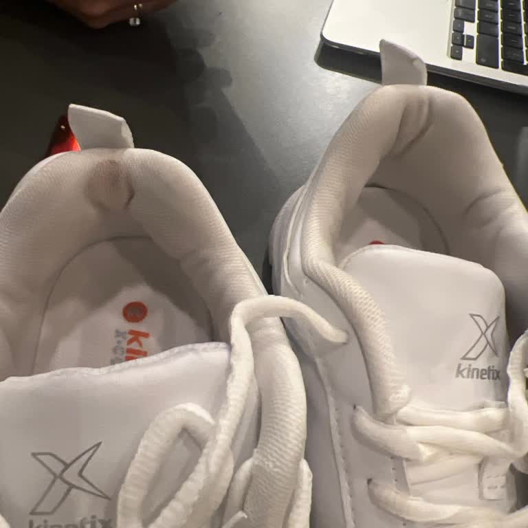 İlk Kullanımda Yaralanmaya Sebep Olan Ayakkabı Ve Mağaza İlgisizliği