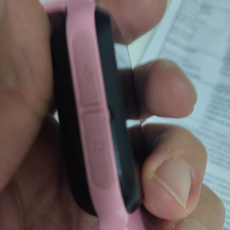 Teknik Servis Sonrası Devam Eden Sorunlar Ve Garanti Kapsamında Mağduriyet