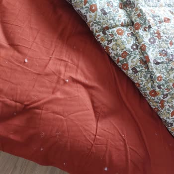 Karaca Uyku Setlerinden Kaynaklanan Pamukçuk Sorunu Ve Alerji Şikayeti