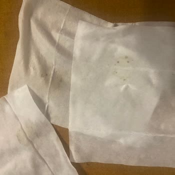 Küflü Islak Mendil: Çocuklarımın Sağlığı Tehlikede!