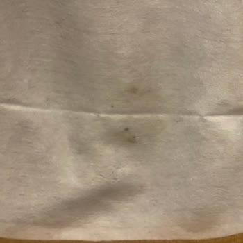 Küflü Islak Mendil: Çocuklarımın Sağlığı Tehlikede!