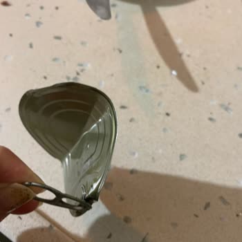 Konserve Kapağı Tehlikeli Açılırken Çocuğumun Parmağı Derin Kesildi