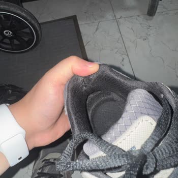 Skechers Ayakkabıda Kısa Sürede Deformasyon Ve Müşteri Hizmetlerine Ulaşılamaması