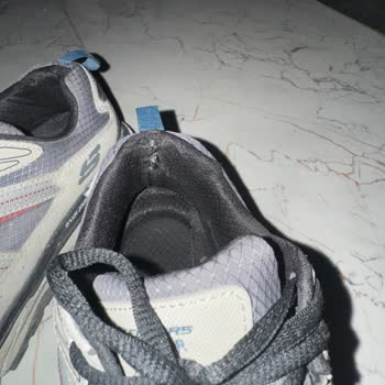 Skechers Ayakkabıda Kısa Sürede Deformasyon Ve Müşteri Hizmetlerine Ulaşılamaması