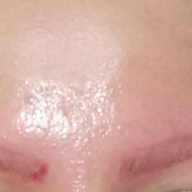 Medikal Güzellik Merkezi Söke /Aydın Yaşadığım Sorun Ve Kaygılarımla İlgilenilmedi!