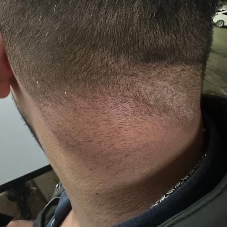 Has Turizm Otobüsünde Hijyen Sorunu ve Tahta Kurusu Mağduriyeti