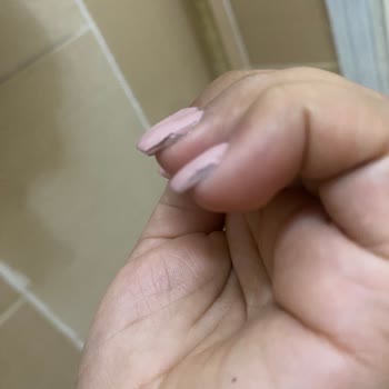 Jel Protez Tırnak Uygulaması Sonrası İlgisizlik Ve Mağduriyet Yaşadım