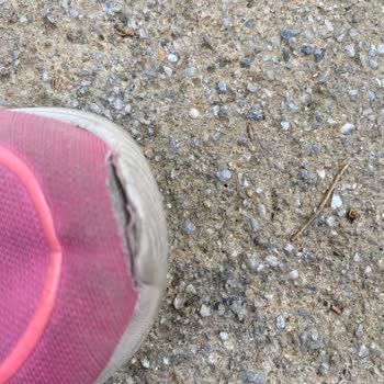 Skechers Ayakkabıda Açılma Ve Müşteri Hizmetleri İlgisizliği