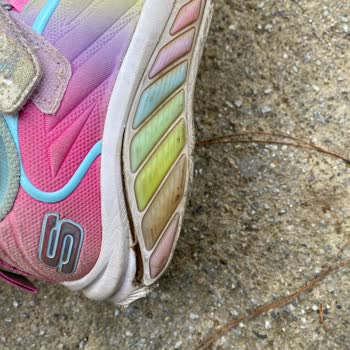 Skechers Ayakkabıda Açılma Ve Müşteri Hizmetleri İlgisizliği