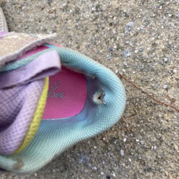 Skechers Ayakkabıda Açılma Ve Müşteri Hizmetleri İlgisizliği