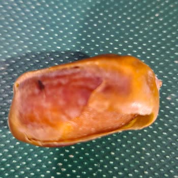 Nakkaşoğlu Kuruyemiş İnsan Sağlığı Açısından Ciddi Bir Risk Oluşturuyor