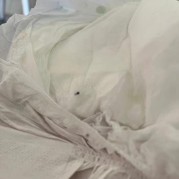 Bebek Bezinde Siyah Ve Sert Cisimle Karşılaştım, Ürün Değişimi İstiyorum