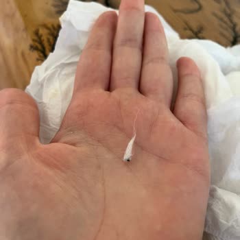 Bebek Bezinde Siyah Ve Sert Cisimle Karşılaştım, Ürün Değişimi İstiyorum