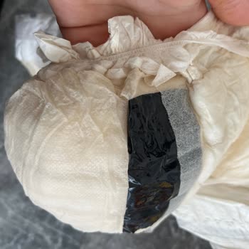 Sleepy Bebek Bezinde Siyah Koli Bandı Şoku: Güvenim Sarsıldı