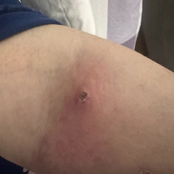 Hastanede İhmal Ve Ticari Yaklaşım Nedeniyle Annemin Sağlığı Tehlikeye Girdi