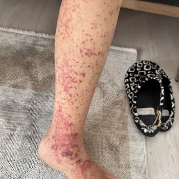 Hastanede İhmal Ve Ticari Yaklaşım Nedeniyle Annemin Sağlığı Tehlikeye Girdi