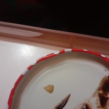 Tatlıdan Tırnağa Benzer Cisim Çıkması Hijyen Endişesi Yarattı