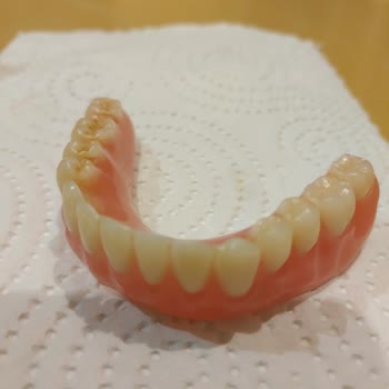 Yanlış Takılan İmplant Ve İlgisiz Doktor Yaşlı Annemi Mağdur Etti