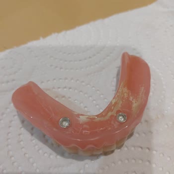 Yanlış Takılan İmplant Ve İlgisiz Doktor Yaşlı Annemi Mağdur Etti