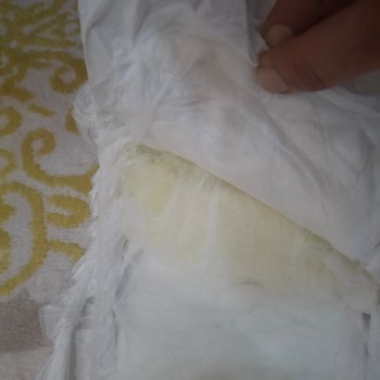 Sleepy 5 Numara Bebek Bezinde Toz Ve Jel Dökülmesi Sorunu