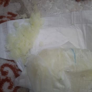 Sleepy 5 Numara Bebek Bezinde Toz Ve Jel Dökülmesi Sorunu