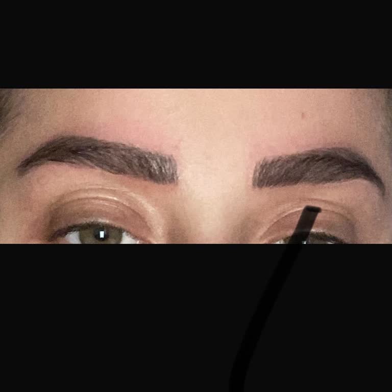 Dr. Fırat Sungar Kaşlarım Kesinlikle Düzgün ve Doğal Görünmedi