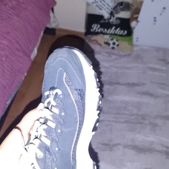 Kısa Sürede Dikişleri Sökülen Ayakkabıya Garanti Kapsamında Çözüm Bulunmadı