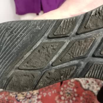 Skechers Ayakkabımın Tabanı Çürüdü, Kullanıcı Hatası Denilerek Mağdur Edildim